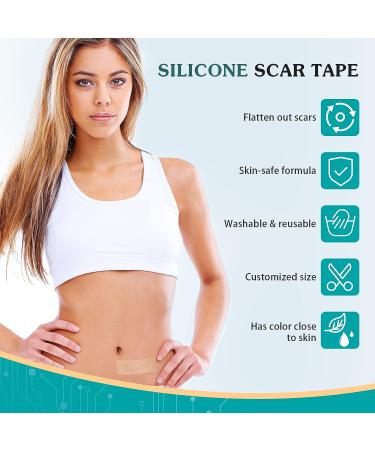 Emibele Silicone Scar Sheets 1.6x120 Roll-3M | Professional Scar Tape for Keloid, Acne, Surgery Scars | Soft & Breathable Silicone Gel Strip for Scar Removal - Buy Online on GoSupps.com