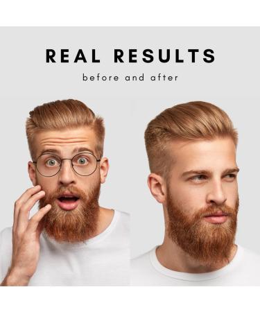 Organic Beard Balm for Thicker Beard Appearance | 12hr Hold | Reduces Irritation & Flaking - 60g - Buy Online on GoSupps.com