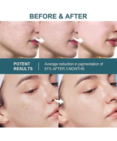 DUBUSH Whitening Serum Capsules Dark Spot Corrector Daily Face Serum Capsules Facial Lightening Cream AntiAging AntiWrinkle Whitening Serum - Buy Online on GoSupps.com