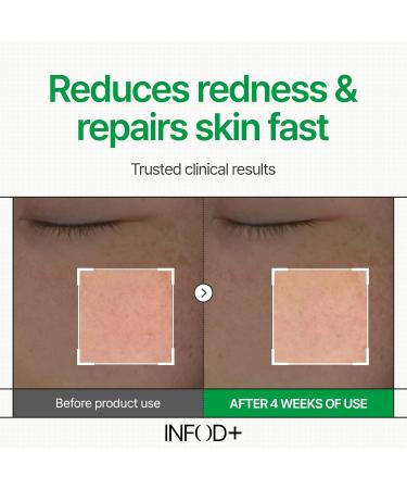 INFODPLUS Korean Skin Care Sensitive Face Cream Lightweight Moisturizer with Ceramides & Panthenol Skin Barrier Support & Deep Hydration Low pH Daily Cream for AM/PM Use 50ml - Buy Online on GoSupps.com