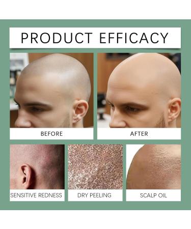 Bald Cream 50g Scalp Care Cream for Men 236 inch moisturizing and nourishing skin cream with natural antishine effect and matte finish for bald wearers - Buy Online on GoSupps.com