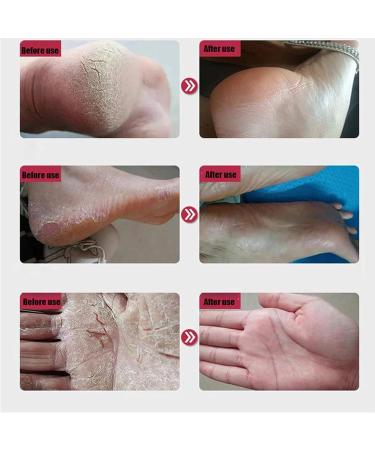 Natural Horse Oil Foot Repair Cream - Anti Cracking Skin Moisturizer for Rough Dry & Cracked Heels - 3PCS for Men & Women - Buy Online on GoSupps.com