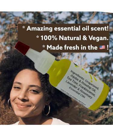 Urban ReLeaf Itchy Scalp Oil Treatment | Soothe Irritation for Braids Wigs & More | Natural Herbal Remedy Made in USA - Buy Online on GoSupps.com