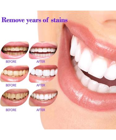 Tooth Mousse Oral Crystal - Purple Toothpaste for White Teeth - Whitening Mousse - Teeth Whitening Toothpaste - Color Correction - Buy Online on GoSupps.com