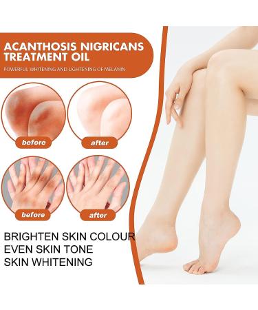 Purer Feminine Intimate Whitening Essence & Dark Knees Serum - (2pcs) - Buy Online on GoSupps.com