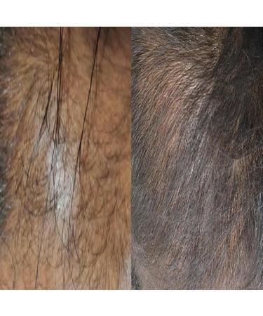 L'essence de biotine adapt e aux hommes et aux femmes renforce apaise et revitalise les follicules pileux quel que soit le type de cheveux. Convient aux hommes comme aux femmes. - Buy Online on GoSupps.com