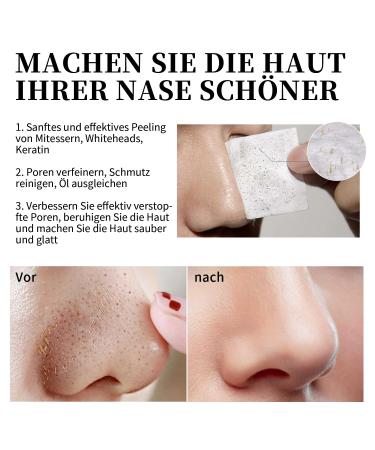 Nanquan Blackhead Remover | Deep-Cleansing Mask & Tear-Off Strips for Flawless Skin - International Shipping Available - Buy Online on GoSupps.com