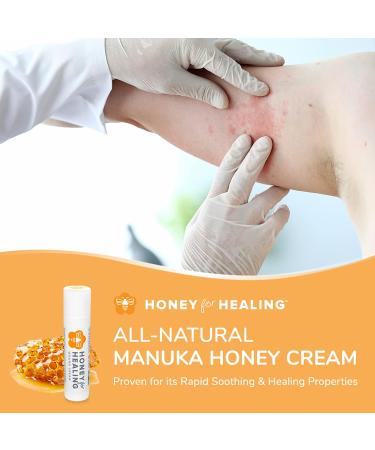 Medical Grade Manuka Honey Healing Cream 15+ UMF | Rapidly Heals Minor Injuries, Burns, Cuts & Scars | 1.75oz - Buy Online on GoSupps.com