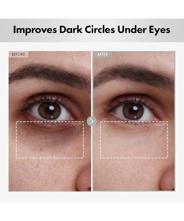 Hyaluron Lifting Eye Cream - Hydrating Under Eye Treatment with Hyaluronic Acid Niacinamide & 5% Arbutin for Dark Circles Puffiness & Fine Lines - Korean Skin Care 15ml - Buy Online on GoSupps.com