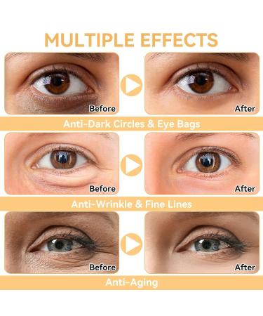 6 Reusable Silicone Under Eye Patches Anti-Wrinkle & Dark Circle Treatment | Overnight Folding Eye Pads - Buy Online on GoSupps.com