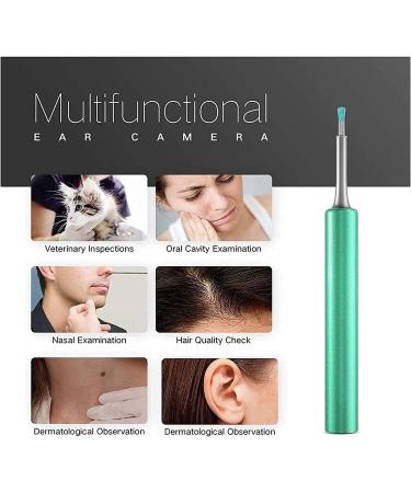 SMSOM Ear Wax Removal Ear Cleaner with Camera HD Endoscope Earwax Remover Tool Wireless Ear Otoscope Ear Cleaning Tool for Kids Adults (Color : Pink) - Buy Online on GoSupps.com