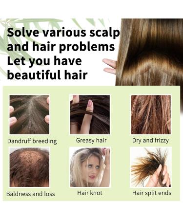 Rosemary Oil for Hair Growth Natural Organic Rosemary Essential Oil and Derma Roller Diluted for Eyelash Beard Eyebrows Face Skin Care Hair Loss Treatment Nourishes The Scalp Improve Blood Circulation - Buy Online on GoSupps.com