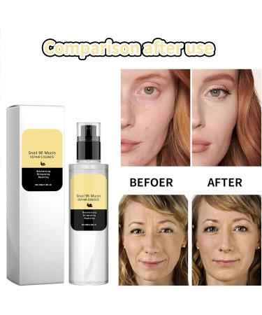 KOAHDE Hydrating Snail Face Serum Brightening Snail Mucin Essence Natural Niacinamide Snail Face Serum Snail Skin Care Face Serum Snail Anti Wrinkle Face Serum Lightweight Face Serum 100ML - Buy Online on GoSupps.com