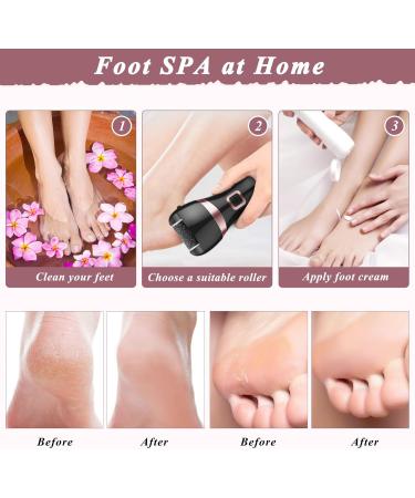 Electric Feet Callus Remover Rechargeable Professional 2 Speeds Electronic Foot File Pedicure Foot Tool Pedi Feet Care with 3 Coarse Roller Heads Black - Buy Online on GoSupps.com