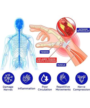 Numbfix Hand and Foot Spray - Effective Relief for Tenosynovitis & Joint Complaints | 2-Piece Multi-Use Spray for All Body Parts - Buy Online on GoSupps.com