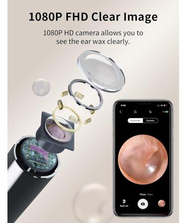 Hopefox Ear Wax Removal Kit Camera | 1080P WiFi Visual Ear Cleaner with Ear Pick Set | 6 LED Earwax Remover for iPhones & Android Phones - Buy Online on GoSupps.com