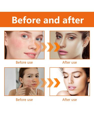  MagiSel Turmeric Toner Facial Toner Turmeric Skin Toner Astringent Pore Lightening Skin Brightening Anti-Aging Facial Toner Daily for All Skin Types 100ml - Buy Online on GoSupps.com