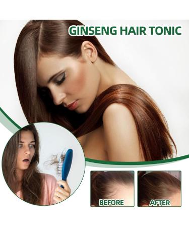100ml Serum Pousse Cheveux S rum Pour La Pousse Des Cheveux D'essence Naturelle de Croissance des Cheveux Contient du Ginseng Favorise la Croissance Naturelle des Cheveux Ingwer - Buy Online on GoSupps.com