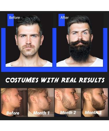 Beard Growth Kit Scdom Grow a Beard Kit for Men with Titanium Derma Roller + Beard Growth Serum Oil + Beard Balm + Beard Cleansing Soap + Comb Beard Grooming Tool Kit Best Gift for Men/Dad - Buy Online on GoSupps.com