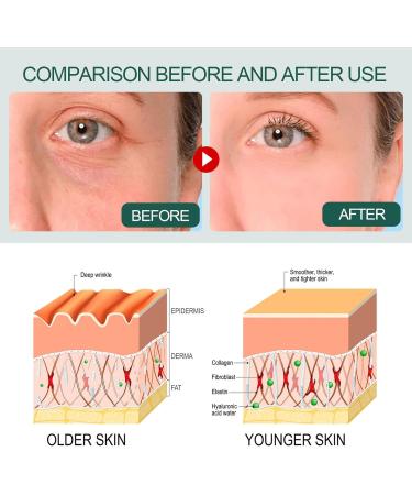 Deep antiwrinkle serum fades the fine lines of the corner of the eyes hydrates firms softens and brightens the skin 30ml - Buy Online on GoSupps.com