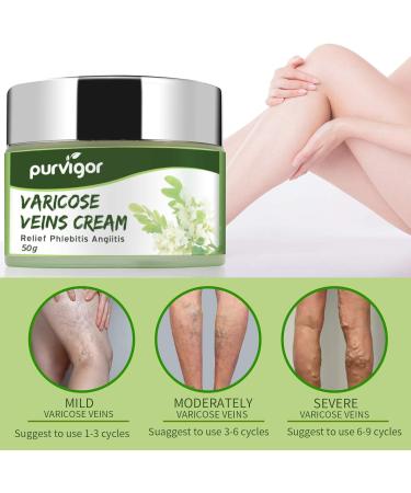 Varicose Vein Cream for Soothing Relief and Improved Capillary Health - Buy Online on GoSupps.com