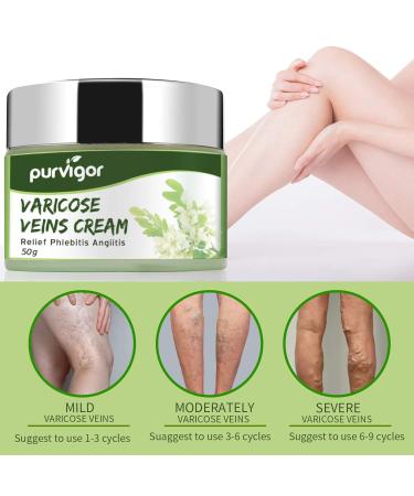Bieyoc Varicose Veins Cream - Fast Relief for Pain & Spider Veins | International Shipping Available - Buy Online on GoSupps.com