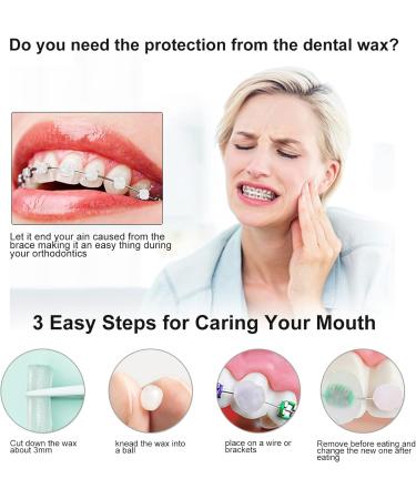 Dental Orthodontic Silicone Wax for Brace Gum Irritation - Pack of 10 in Various Colors & Scents - Buy Online on GoSupps.com