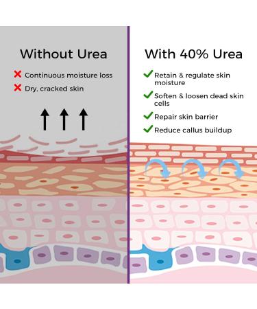 Masque Exfoliant pour Pieds 3 Paires : Masque Exfoliant pour Pieds Dermatologiquement Test Talons et Peau Morte S che pour des Pieds Doux Masque Exfoliant pour Pieds (Lavande) - Buy Online on GoSupps.com