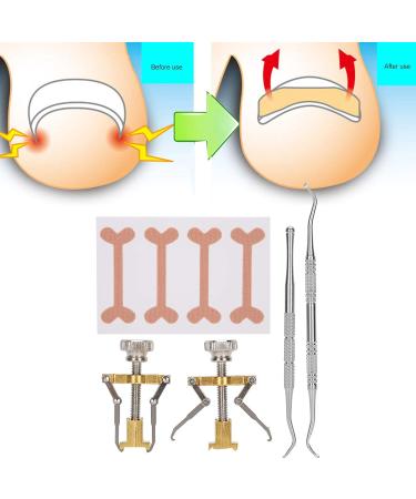Ingrown Toenail Correction Tool Set - Anggrek Self-Adhesive Solutions for Effective Relief - Buy Online on GoSupps.com