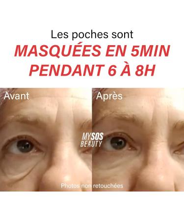 My Sos Beauty Correcting Gel for Eyes - Temporary Lifting Cream for Eyes - Anti-Aging Eye Lift Cream - Instant Lifting Effect - Buy Online on GoSupps.com