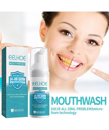 2Pcs Whitening Mouthwash Mousse for Calculus Removal & Fresh Breath - Buy Online on GoSupps.com