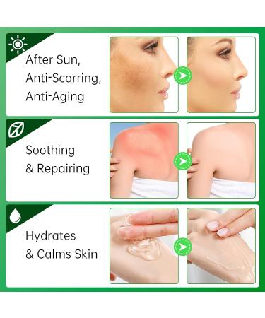 Aloe Vera Moisturizer for Face - Skin Repair, Sunburn Relief | Anti-Scarring & Aging | ECO-FRIENDLY & CRUELTY-FREE - Buy Online on GoSupps.com