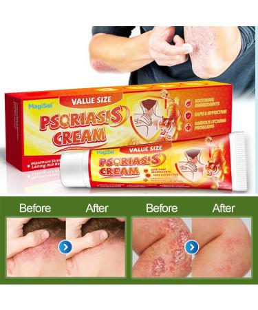  MagiSel Anti-itch ointment skin cream soothing skin cream for itching and psoriasis natural care formula cares for and soothes the skin suitable for skincare - Buy Online on GoSupps.com