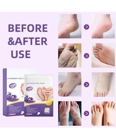 2Pairs Lavender Feet Peeling Socks Foot Moisturiser Socks Foot Masks Remove Hard Skin Callus Remover For Feet Foot Mask For Dry Cracked Feet Exfoliating Foot Peeling Mask For Hard Skin Hand Foot Mask - Buy Online on GoSupps.com