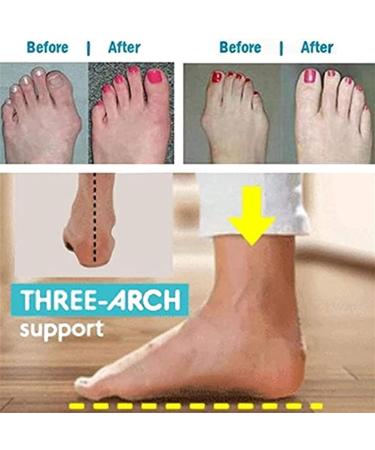 Women's Sandals with Bunion Support | Slip-On Chunky Heel Orthopedic Corrector | Summer Beach Vacation Casual Sandals - Hallux Valgus & Toe Separator (Brown - Buy Online on GoSupps.com