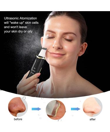 Qukot Ultrasonic Skin Scrubber Spatula - Blue-Light Upgraded Blackhead Remover & Pore Cleaner for Deep Facial Cleaning - Comedone Extractor for Women and Men - Buy Online on GoSupps.com