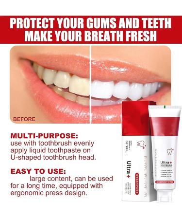 Lovelycat SP-4 Whitening Toothpaste - Super Prebiotic Fresh Breath Formula for All Oral Issues (2PC-3) | International Shipping - Buy Online on GoSupps.com