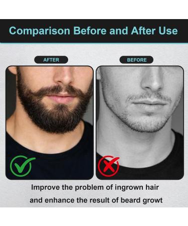 Jelly Beard Oil Huile Barbe Homme Huile de Barbe Homme Hydrate et Favorise la Pousse Etape D Entretien Pour Tous Les Types de La Barbe-Adoucit - Buy Online on GoSupps.com