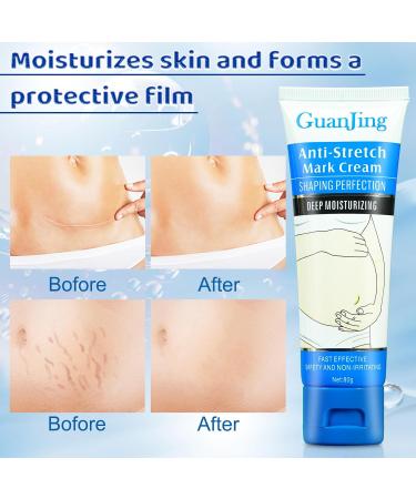 Best Stretch Mark Removal Cream - Pregnancy & Scar Treatment | Deep Repair Belly Butter 2.82 Oz - Buy Online on GoSupps.com