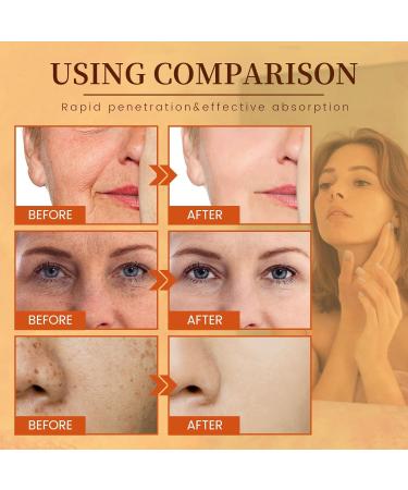 Vitamin C Face Serum with Hyaluronic Acid & Glycerol | Anti-Wrinkle Boost Collagen Even Skin Tone | 30 ml - Buy Online on GoSupps.com