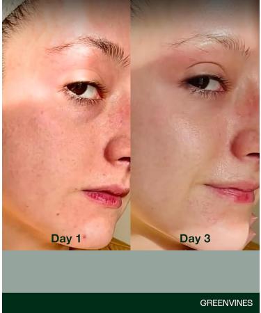 Greenvines Luminosity Anti-Aging Serum | Hydrating & Brightening for Sensitive Skin | 0.3 Fl oz - Smooth Radiant Complexion - Buy Online on GoSupps.com