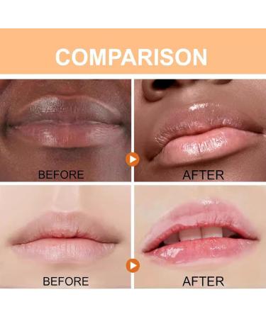  homomdy Turmeric Lip Balm for Dried and Cracked Lips Turmeric Lip Lightening for Dark Lips Lip Wrinkle Reduction Dull Dark Lip (6pcs) - Buy Online on GoSupps.com