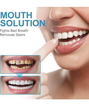 KLYso Powerful Teeth Cleaning Toothpaste for Fresh Breath Stain Removal Whitening & Gum Care(3PCS) - Buy Online on GoSupps.com