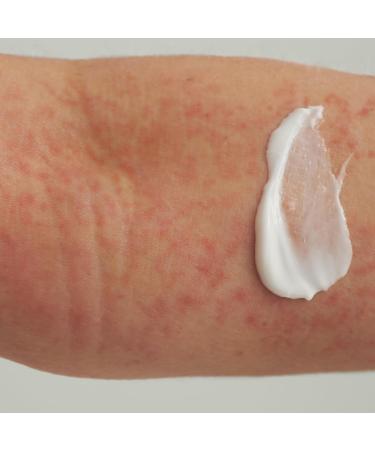 DADO SENS EXTRODERM Skin Balm (200 ml) For atopic dermatitis and psoriasis nourishes and soothes dry skin of all ages Particularly gentle moisturizing vegan - Buy Online on GoSupps.com