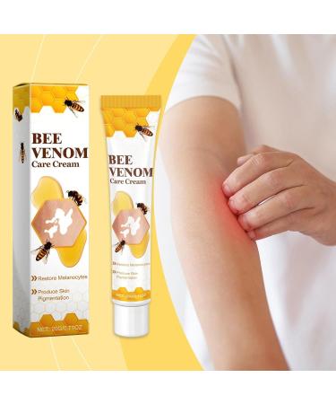 Itch Relief Cream Itch Relief Lotion Redness Relief Cream Rash Cream For Itching External Ointment For Itching Skin Rash Relief Cream Anti-itch Ointment Itchy Skin Cream 20g Rash Cream - Buy Online on GoSupps.com