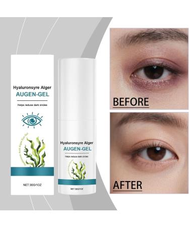  Zasdvn Eye Care Cream For Women | 30g Moisturizing Balm - Under Eye Bags Cream - To Moisturize Skin Reduce Goose's Feet Repair Dry Skin Eliminate Swelling - Buy Online on GoSupps.com