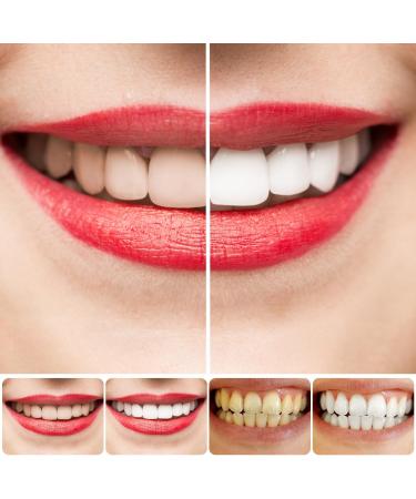 SP-4 Probiotic Whitening Toothpaste - Fresh Breath & Stain Removal (2 Pcs + 2 Toothbrushes) | International Shipping Available - Buy Online on GoSupps.com