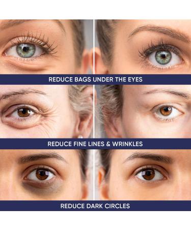 Instant Ageless Eye Cream - Anti-Wrinkle Solution for Puffiness Bags Dark Circles & Sagging Skin - Immediate Results - Buy Online on GoSupps.com