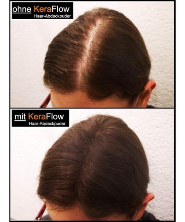 KeraFlow Root Powder - Hair Concealer & Thickener for Grey Hair | 4g Dark Brown - Best Solution for Thinning Hair - Buy Online on GoSupps.com