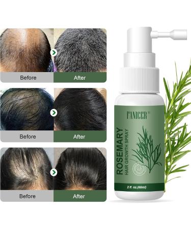 2 * 60ml hair serum hair growth serum hair growth oil hair loss for women anti hair loss for men Promotes Hair Growth - Buy Online on GoSupps.com